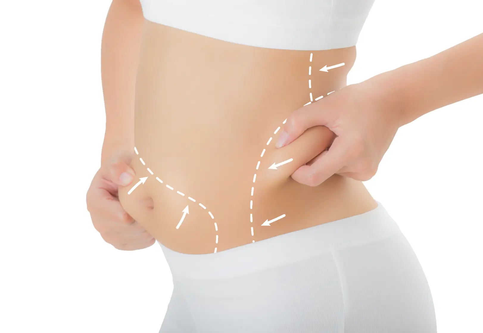 Abdominal Contour Lines And Arrows Case #12774 - Pancholi Cosmetic Surgery